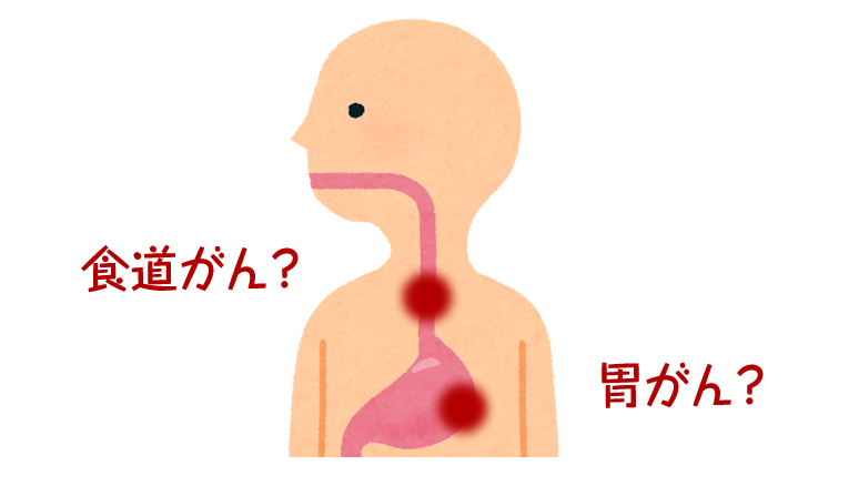 胃がん、食道がんは、どんな症状？