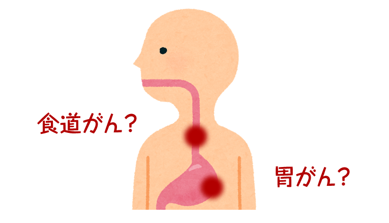 鼻から胃カメラで 胃がん 食道がんを早期発見 草花クリニック あきる野市 内科 訪問診療 リハビリ