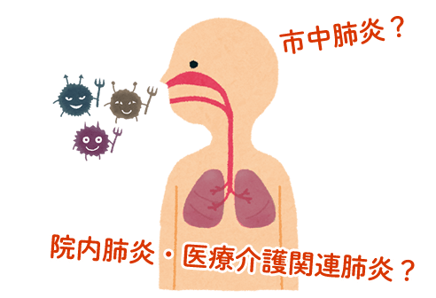 肺炎は大きく二つの分類に分かれる