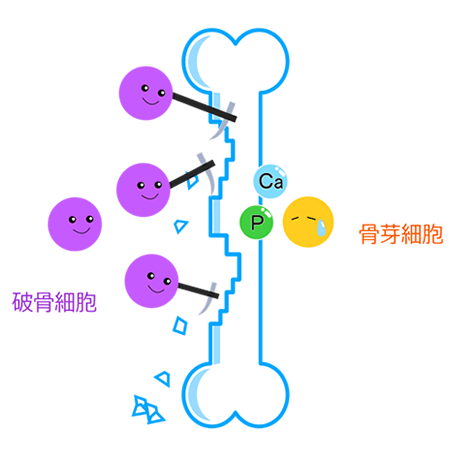 骨粗鬆症の骨のリモデリング